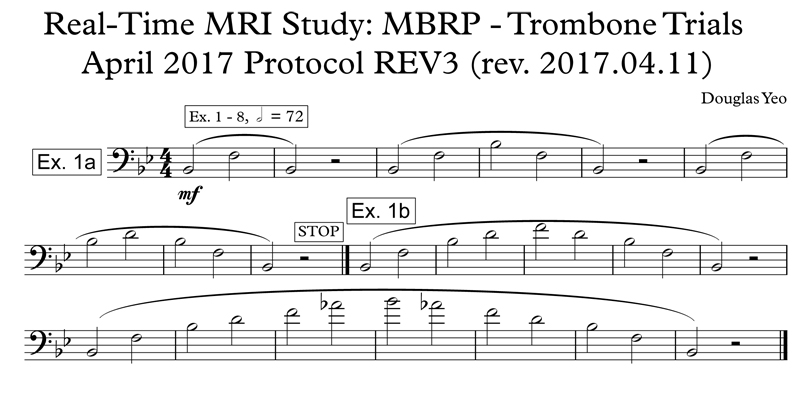 Trombone_MRI_protocol_Yeo_REV3